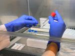 Archivo - Arxive - la PCR amb mostra en saliva per a detecci&oacute; de Covid-19