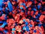 Micrograf&iacute;a electr&oacute;nica de barrido de c&eacute;lulas humanas (azul) infectadas con SARS-CoV-2 (rojo).