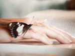 La 'piel de mariposa' provoca una gran fragilidad cut&aacute;nea.