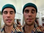 Justin Bieber ha mostrado en Instagram los efectos del virus que le ha paralizado medio rostro.