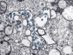 Part&iacute;culas del virus SARS-CoV-2, coloreadas en azul, en una imagen de microscopio de electrones.
