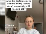 Joven embarazada pensaba que tenía una piedra en el riñón.