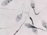 Espermatozoides, a vista de microscopio(AGENCIAS).