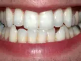 dientes, boca, sonrisa, dentadura