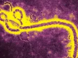 Imagen del virus del Ébola bajo el microscopio.
