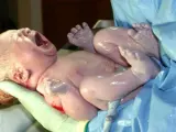 Beb&eacute; asistido durante un parto.