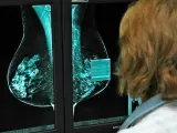 Las mamograf&iacute;as son un paso esencial en la detecci&oacute;n.