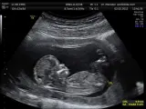 <p>Imagen de una ecografía y de un feto en el interior de un vientre materno.</p>
