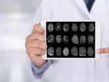 Radiografía cerebro humano.