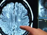 Radiografía del cerebro.