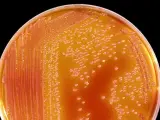 Bacteria Serratia.