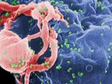 Virus de la sida, en una imagen de Wikipedia.