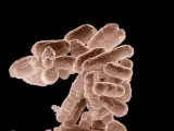 Cúmulo de bacterias E. Coli.