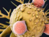 Células-T atacando al cáncer