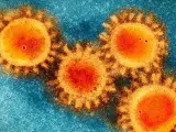 Foto de microscopio electrónico del coronavirus Covid-19 Foto de microscopio electrónico del coronavirus Covid-19 18/3/2020