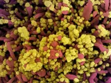 Una imagen captada con un microscopio electrónico y coloreada muestra una célula infectada por el coronavirus SARS-COV-2 (en amarillo), obtenida de la muestra de un paciente de COVID-19.