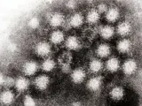 Partículas de norovirus, al microscopio.