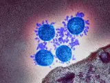 Imagen electr&oacute;nica coloreada de una part&iacute;cula de coronavirus aislada en Reino Unido.