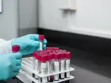 Muestras de análisis de sangre en un laboratorio.