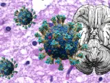 El coronavirus podr&iacute;a causar da&ntilde;os cerebrales similares a los observados en el Alzheimer.