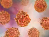 Los investigadores descubren una forma de aprovechar el poder de la inmunoterapia para el cáncer de próstata avanzado