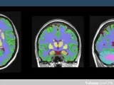 La UPV y el CNRS de Francia crean una nueva herramienta online para el estudio del cerebro