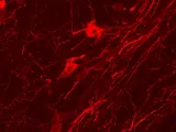 Microfotografía de neuronas de la sustancia negra, que liberan dopamina ante novedades y recompensas generando una situación placentera.