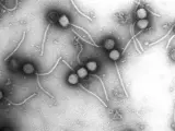Imagen al microscopio de unos virus bacteriófagos.