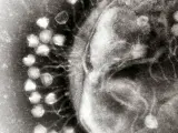 Imagen de microscópica que muestra un grupo de virus bacteriófagos acoplados en una célula bacteriana.