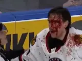 Imagen de la pelea en la AHL de hockey sobre hielo.