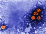 Imagen de microscopía electrónica de transmisión coloreada digitalmente revela la presencia de viriones de la hepatitis B (de color naranja).