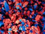 Micrografía electrónica de barrido de células humanas (azul) infectadas con SARS-CoV-2 (rojo).