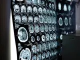 Un estudio utilizó la resonancia magnética para ver cómo era el cerebro de las personas creativas.