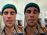Justin Bieber ha mostrado en Instagram los efectos del virus que le ha paralizado medio rostro.