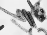 Imagen microsc&oacute;pica del virus de Marburgo.