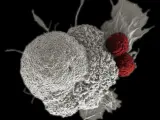 Imagen de archivo de una célula citotóxica (rojo) atacando a otra cancerosa (blanco).