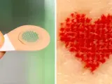 Agujas microscópicas que pueden suponer la llegada de los tatuajes indoloros.