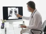 Un médico examina una radiografía torácica.