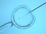 Fertilización de un óvulo