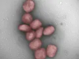 Partículas del virus de la viruela del mono teñidas de rojo.