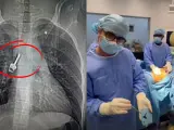 La increíble operación del cirujano español Diego González