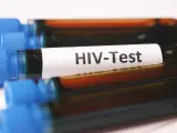 Imagen de un test de IVH.