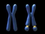 En el síndrome x frágil, el cromosoma X está dañado.