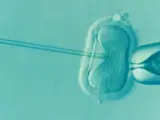 Inyección intracitoplásmica de espermatozoides (ICSI), una de las técnicas de reproducción asistida.