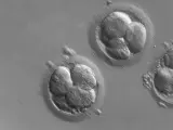 Embriones humanos obtenidos por técnicas de reproducción asistida.