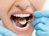 Caries dentales