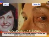 'Espejo Público' ha mostrado el antes y el después del ojo de Domi.