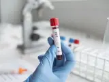 Prueba de VIH