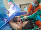 Protocolo "piel con piel" en un parto por cesárea.