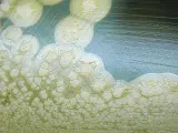 Colonias de la bacteria 'Clostridium botulinum' creciendo en una placa de cultivo.